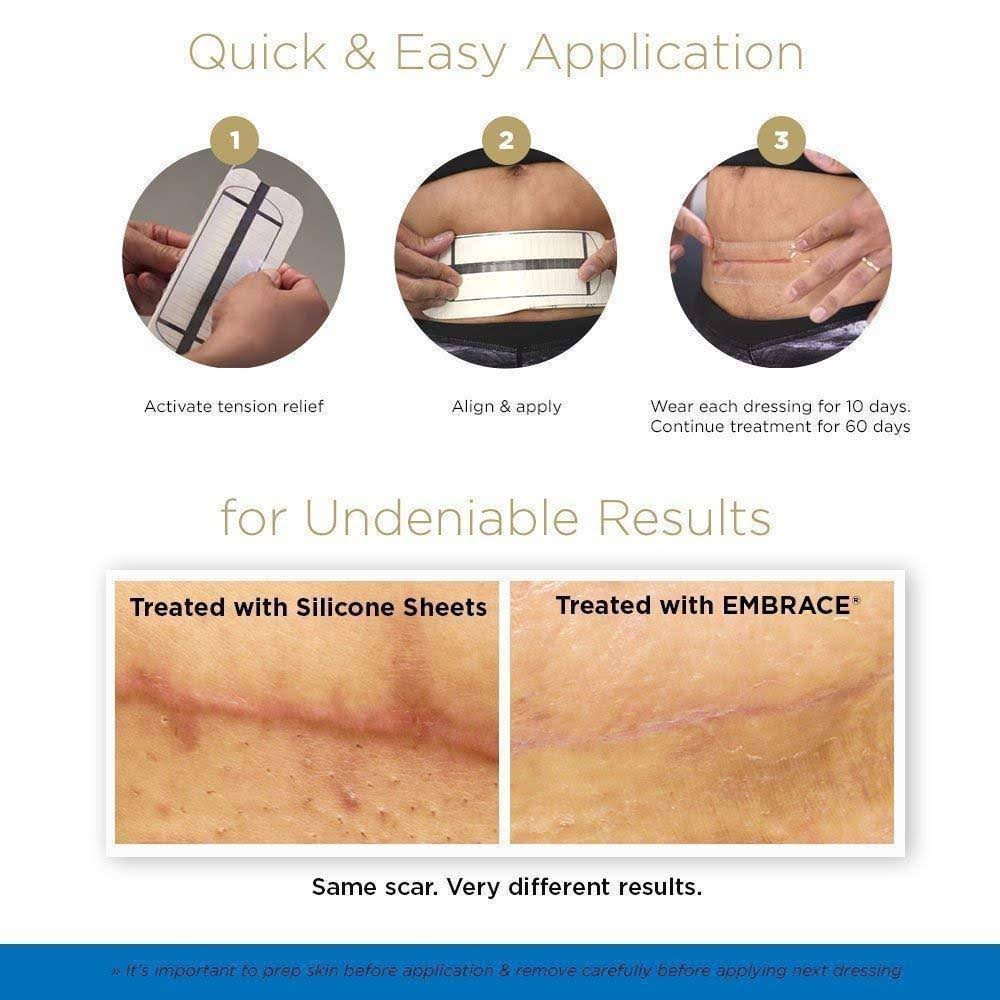 Silicone Sheets for New Scars Z99122